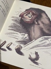 Great Operations Of Surgery By Charles Bell – Classics Of Mesicon Library-illust