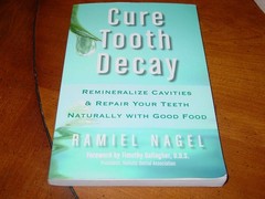 Cure Tooth Decay: Heal and Prevent Cavities with Nutrition, 2nd Edition – pa…