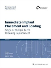 Immediate Implant Placement and Loading: Single or Multiple Teeth Requiring …